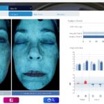 Shelly gallegos_Compare_UV Spots2